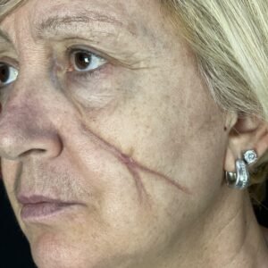 1. Special Effects - Cicatrice Collodion e con Wax