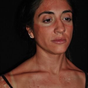 2. Special Effects - Effetto Abbronzatura e Bruciatura da Sole