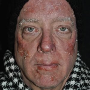 6. Special Effects - Effetto Esposizione Caldo e Freddo